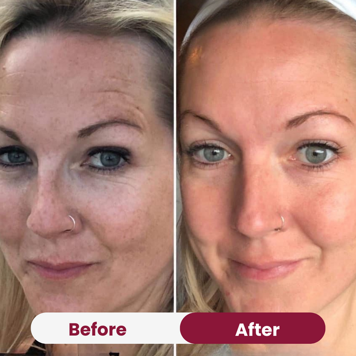 Anti-Aging Power Duo