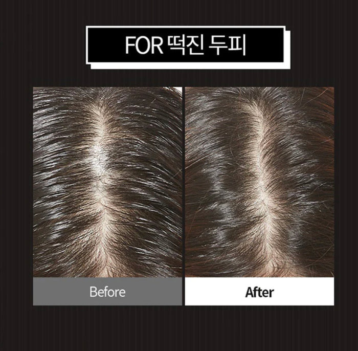 A'Pieu Oily Hair Dry Powder باودر ازالة دهون الشعر من ايبيو