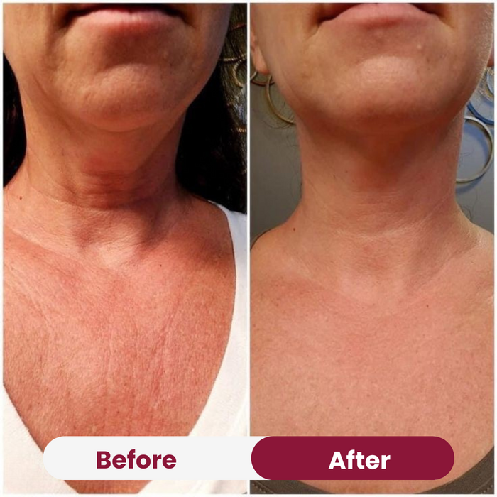 Chest Anti-Wrinkle Patch