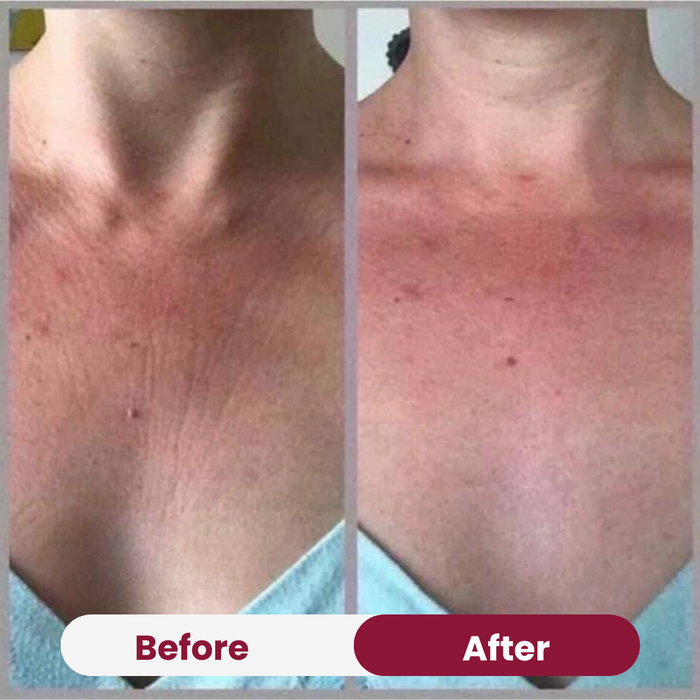 Chest Anti-Wrinkle Patch