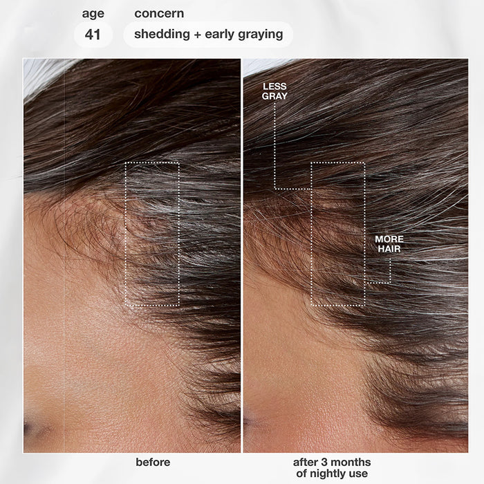 FutureIQ™ Biomimetic Hair Longevity Serum 90ml