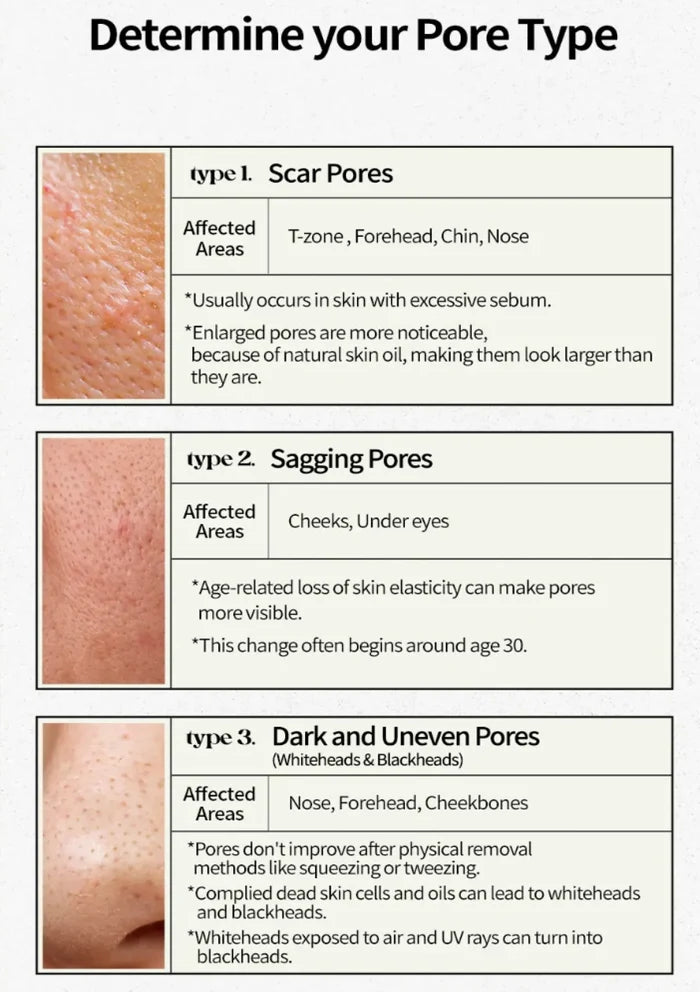 Chart detailing different types of pores with skin images and descriptions.
