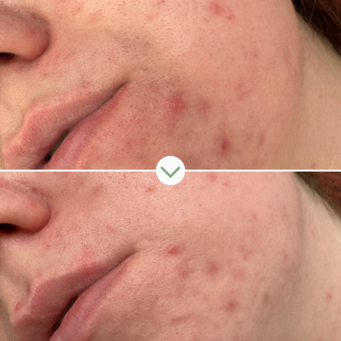 Pai Skincare-Phaze Rebalance Cleanser-Skincare-5060139729048_5-The Detox Market |