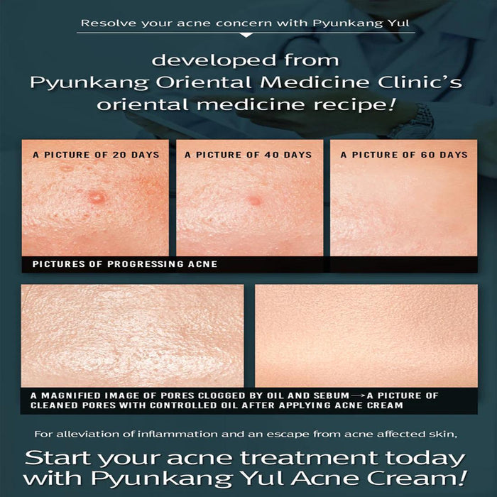 Pyunkang Yul Acne Cream 50 mL